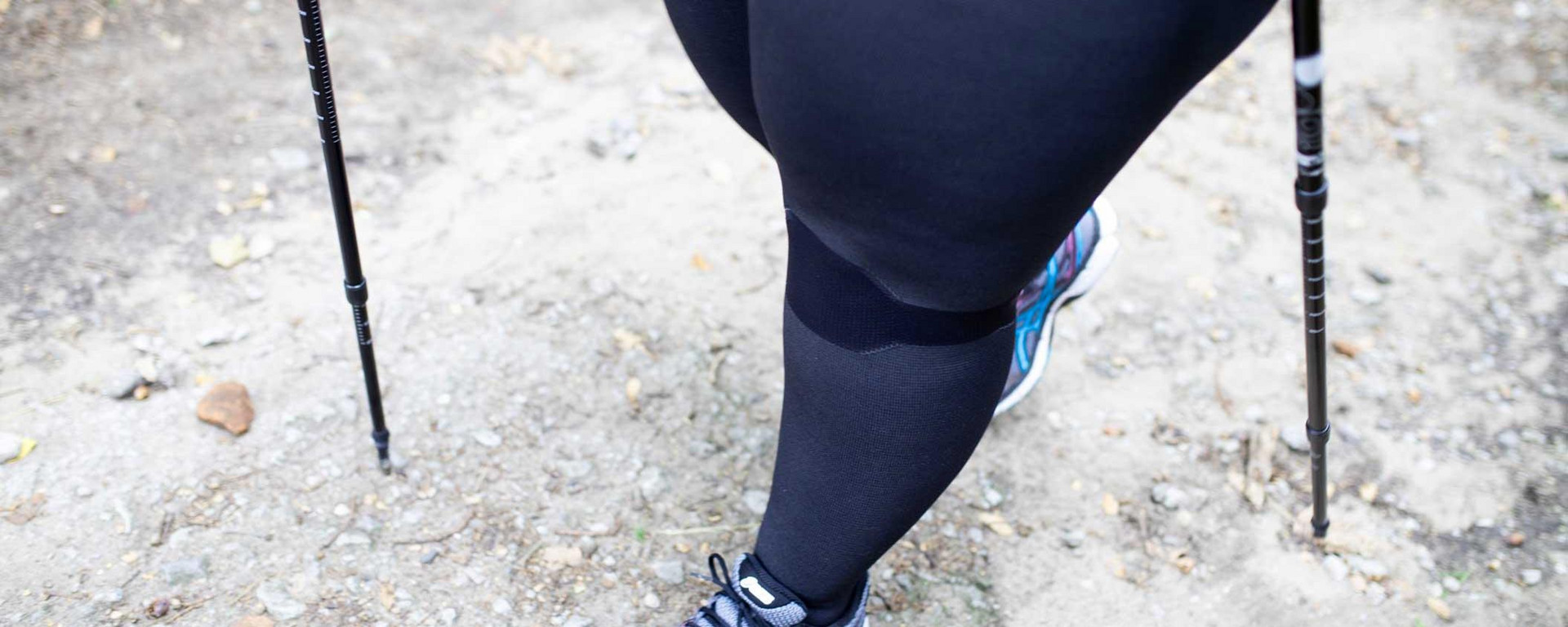 Compression Stockings as a Treatment Option for Lipedema and